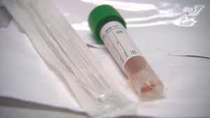 ISP publica listado de 12 kits de test rápido que sirven para detectar la presencia de covid-19