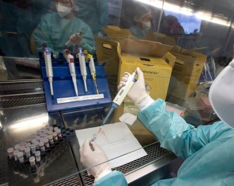 La vacuna contra el coronavirus desarrollada por la universidad de Oxford comenzó a ser probada en Brasil