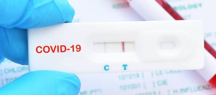 TEST RÁPIDOS ¿QUE SON?