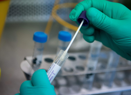 Investigan caso de paciente que podría haberse reinfectado con coronavirus en Atacama