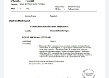 PCR negativo para cada uno de los funcionarios de la Gobernacion de Osorno.