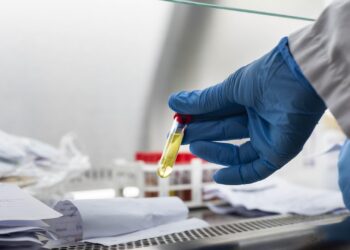 Balance Covid-19: 28 casos nuevos registró provincia de Osorno este sábado