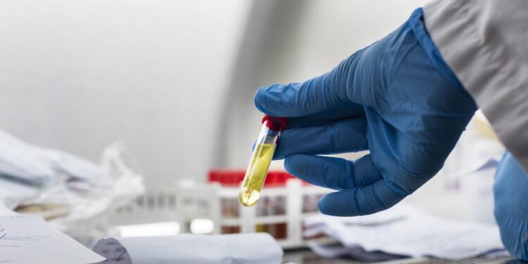 Balance Covid-19: 28 casos nuevos registró provincia de Osorno este sábado