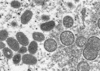 Seremi de Salud Los Lagos afirma que red está atenta a posibles casos de viruela del mono
