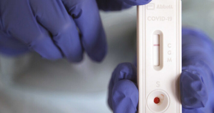Minsal prepara resolución para que test de antígenos autoaplicados accedan a licencia médica por covid-19