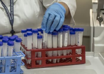 Infectóloga hospital de Osorno por viruela del mono: “Requiere un contacto muy estrecho”