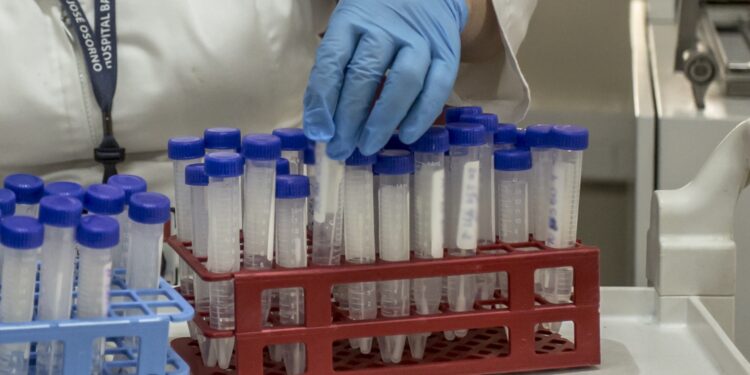 Infectóloga hospital de Osorno por viruela del mono: “Requiere un contacto muy estrecho”