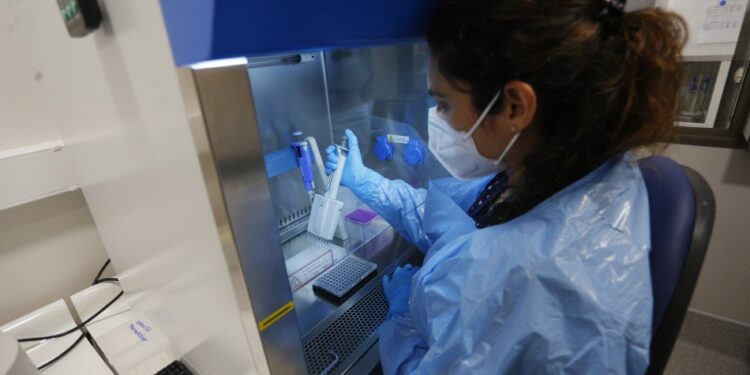 Ministerio de Salud confirma 189 contagios de viruela del mono en Chile