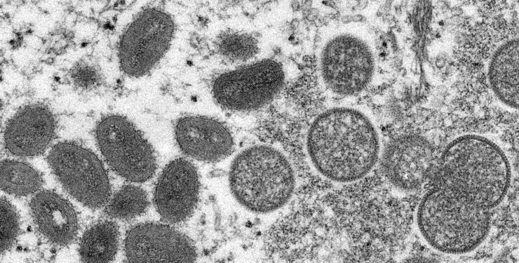 Ministerio de Salud reportó 210 casos de viruela del mono en el país