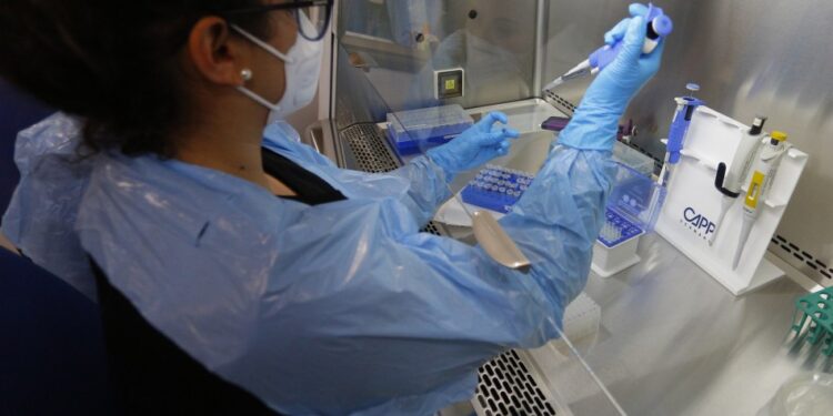 Ministerio de Salud confirman 141 casos de viruela del mono en Chile