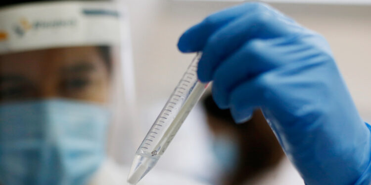 Minsal informó del segundo fallecido por viruela del mono en Chile