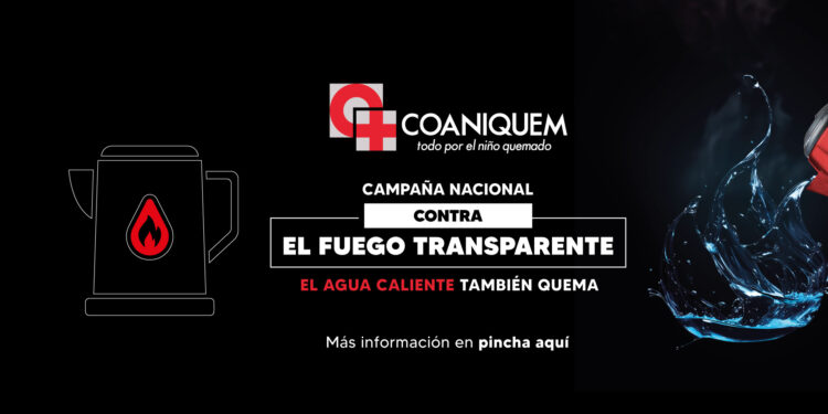 Coaniquem llama a evitar quemaduras por líquidos calientes