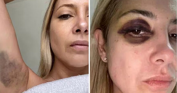 Argentina: Con fotografías, expareja de Alberto Fernández lo denunció por violencia de género
