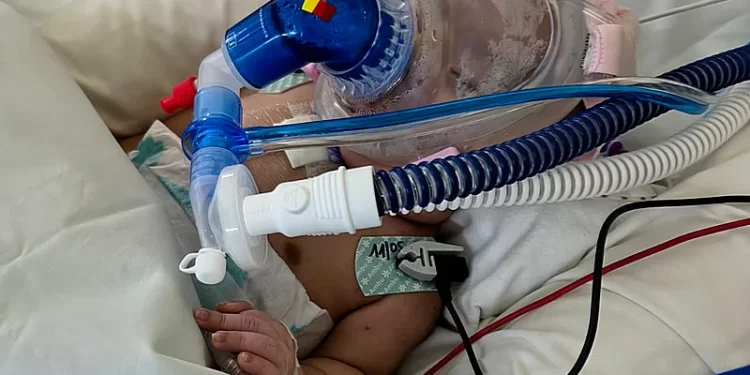Osorno: Lactante con cardiopatía compleja espera avión ambulancia